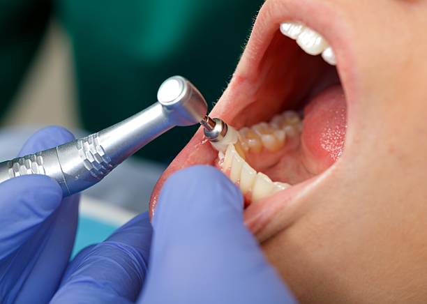 Laser Dentistry in Sylacauga, AL